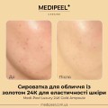 Омолаживающая сыворотка с золотом MEDI-PEEL Luxury 24K Gold Ampoule, 100 мл